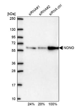 NONO Antibody, Novus Biologicals 0.1mL; Unlabeled:Antibodies, Polyclonal